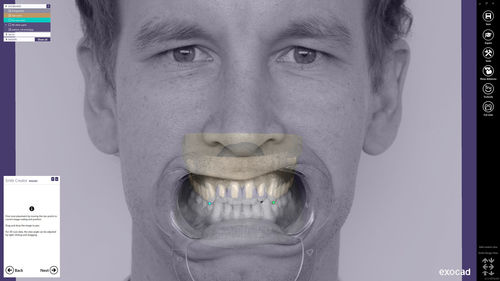 Analysis software - Smile Creator - exocad GmbH   - planning / design / CAD