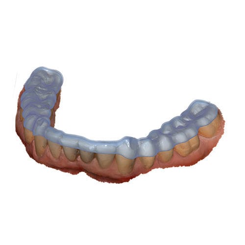 Design software module - Bite Splint - exocad GmbH   - dental / joint