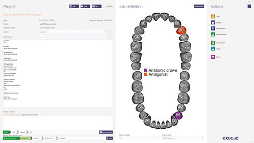 Management software - dentalshare - exocad GmbH   - design / CAD / sharing
