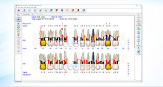 Image analysis software -  FP32  - Floridaprobe Thomas Wientjens   - recording / education / screening