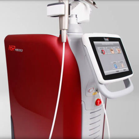 Lipolysis laser - TimeWalker® Fotona4D® - Fotona - Nd:YAG / Er:YAG / trolley-mounted