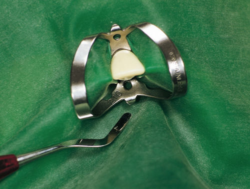 Clamp for dental dam - 355335 - Hager & Werken