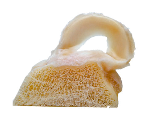 Allograft meniscus implant - FlexiGRAFT®  - Lifenet Health  
