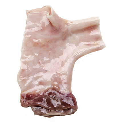 Pulmonary artery vascular bioprosthesis - CardioGraft ® - Lifenet Health   - allograft