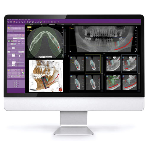 Dental imaging software iRYS MyRay planning / for dental implant