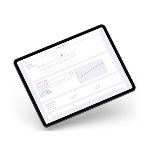 Treatment web application - OSSTELL AB   - medical / clinical / dental
