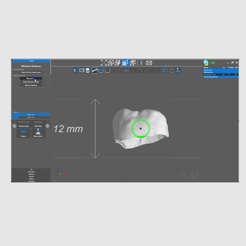 Visualization software - PICASOFT SAS   - dental / automated / automated