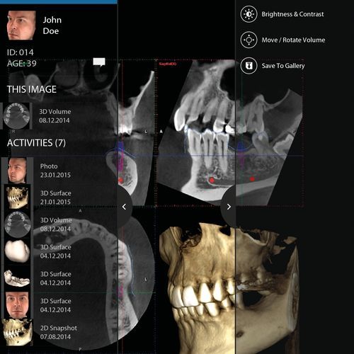 IOS visualization application - mRomexis™ - Planmeca - capture / clinical / dental