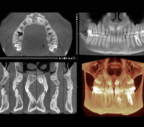 Medical software - Romexis® - Planmeca - dental / medical imaging / maxillofacial surgery