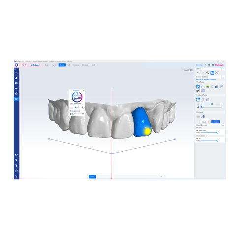 Dental implantology software - Romexis® - Planmeca - planning / design / medical
