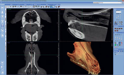 Image analysis software - Romexis® - Planmeca - image enhancement / visualization / diagnostic