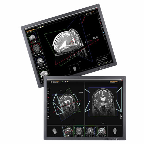 Preoperative planning software - neuroinspire™ - Renishaw - medical / for stereotactic neurosurgery / automated