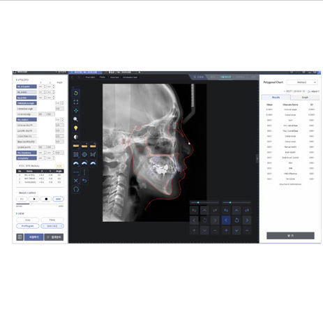 Cephalometric analysis software - WillCeph Pro - HDX Will - design / orthodontic