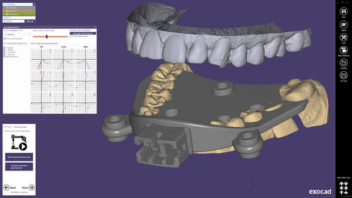 Design software - exocad  - smart optics Sensortechnik GmbH   - CAD / dental / Windows