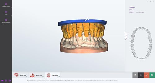Dental laboratory software - smart optics Sensortechnik GmbH   - management / viewer / design
