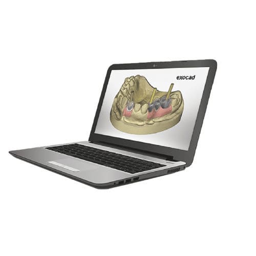 Clinical software exocad TBR Implants Group for dental