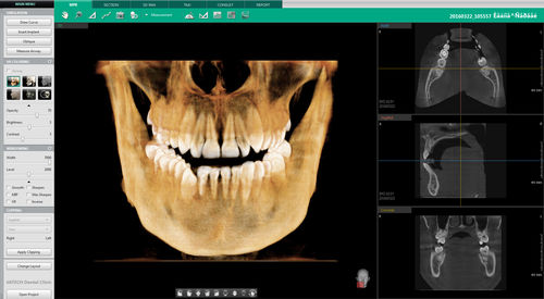 Analysis software - Ez3D-i™ - VATECH Networks - diagnostic / simulation / planning