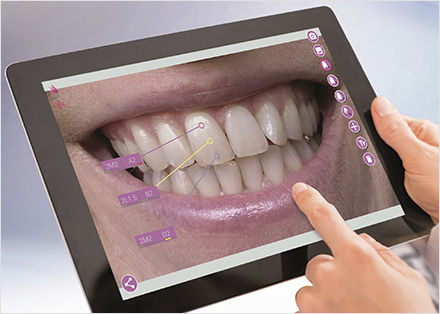 Visualization software - mobileAssist - VITA Zahnfabrik H. Rauter GmbH & Co.KG   - treatment / simulation / planning