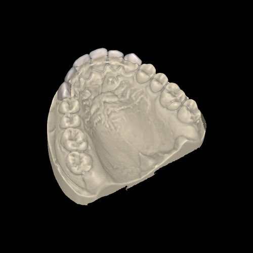 CAM software module - Prettau®   - Zirkonzahn - CAD / for dental prosthesis design / for dental laboratories