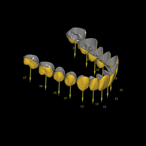 Import software module - Eggshell Temporary - Zirkonzahn - CAD / CAM / dental