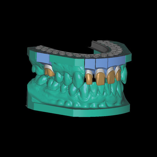 Modeling software module - Model-Maker - Zirkonzahn - 3D simulation / CAD / CAM