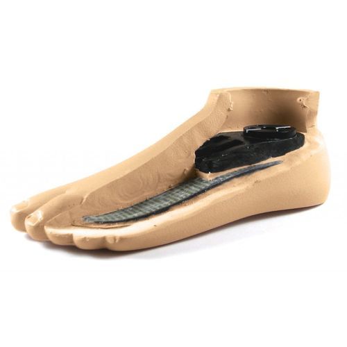 Dynamic prosthetic foot - PPI-17LM-3 - WillowWood - K1 / for walking / pediatric