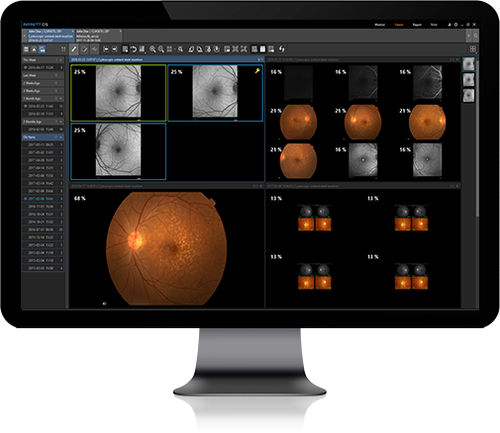 Management software - Infinitt Healthcare - viewer / tracking / medical