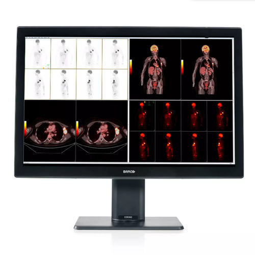 Medical display - MDCC-6530 - Barco - diagnostic / high-definition / 30.4in