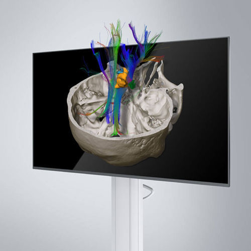 DICOM viewing software module - Brainlab - planning / contour detection / multimodal image fusion