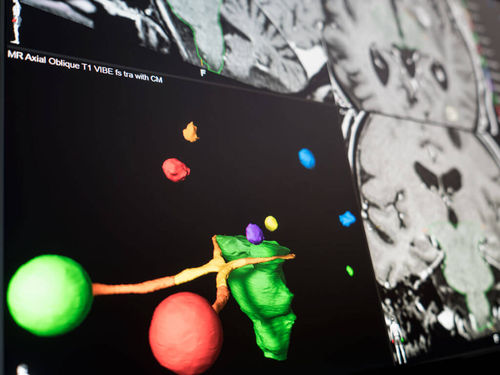 Visualization software - Brainlab - preoperative planning / treatment planning / treatment