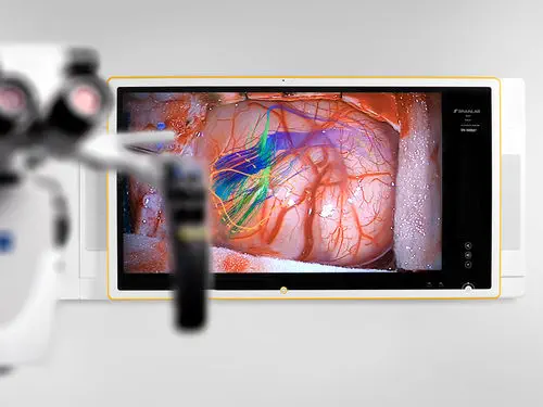 Data management and communication system - Buzz™ - Brainlab