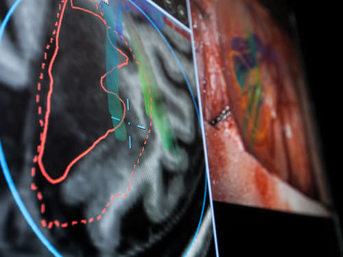 Neuronavigation software - Brainlab - eye tracking / hospital / surgery