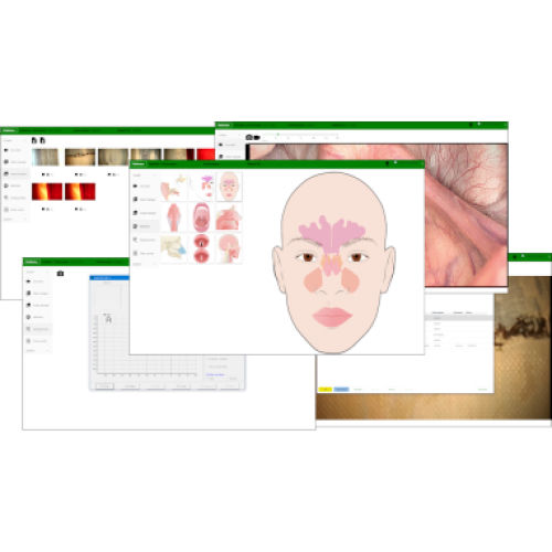 Treatment software - IVM - Entermed - medical / hospital / for endoscopy