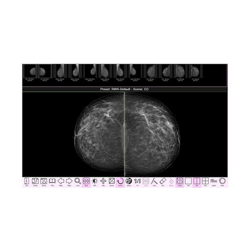 Image analysis software - RAFFAELLO  - IMS - acquisition / navigation / clinical