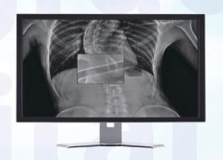 Visualization software - MADXVIEW - Medonica - radiology / for tablet PC
