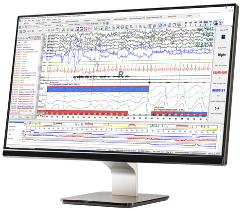 Management software - SleepWorks™ - Natus Medical - analysis ...
