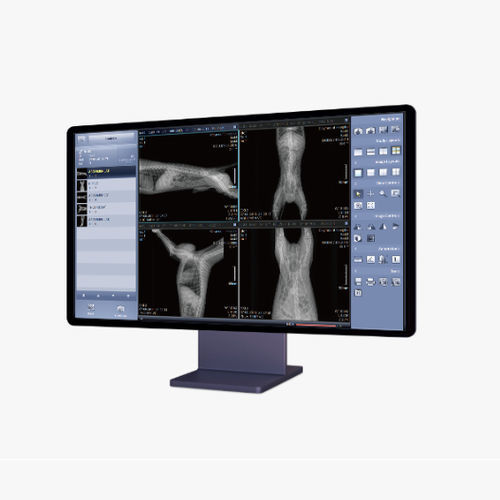 Medical imaging PACS VXV Rayence