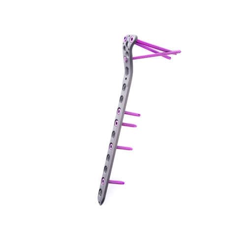 Tibia compression plate - Vortex  - Sanatmetal - proximal / lateral / locking