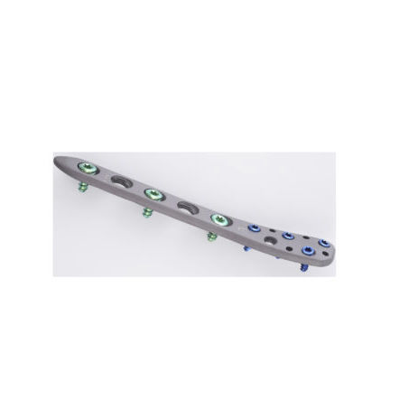 Fibula compression plate - Vortex  - Sanatmetal - distal / lateral / locking