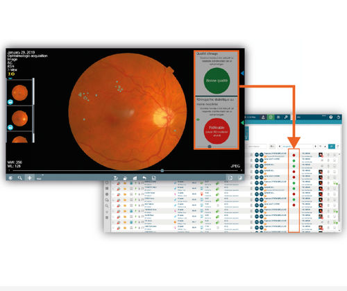 Management software - OphtAI - EVOLUCARE - diagnostic / diabetic retinopathy detection / ophthalmology