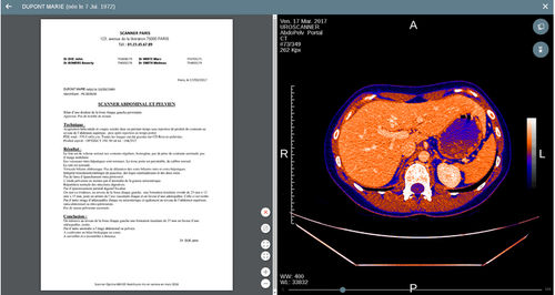 Viewer software - Uview - EVOLUCARE - diagnostic / measurement / sharing