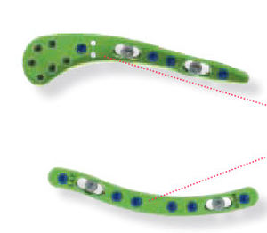 Clavicle compression plate - CBTGLN1 - Newclip Technics - lateral / medial / locking