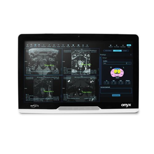 Intel® Core i3 medical panel PC - MATE2-2215 - Onyx Healthcare Inc - Intel® Core™ / Intel® Core i5 / Intel® Core i7