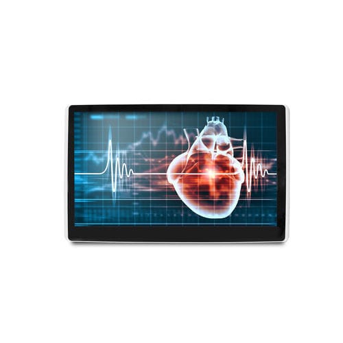 Medical display - MEDDP-615 - Onyx Healthcare Inc - 18.5" / LCD / LED-backlit