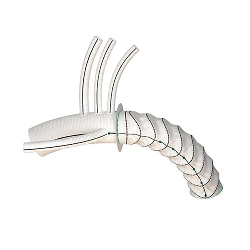 Aortic arch stent graft - Thoraflex™ - Terumo Aortic