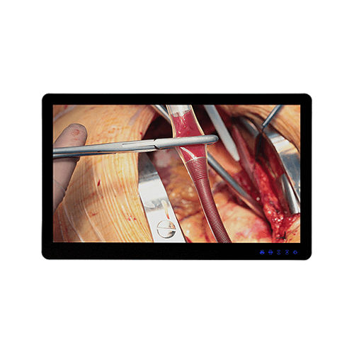 Medical display - MSAP5521AMA - Avalue Healthcare - medical imaging / surgical / 3840 × 2160