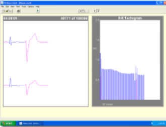Reporting software - Trillium Platinum™ - Forest Medical - analysis / medical / for cardiac Holter monitors