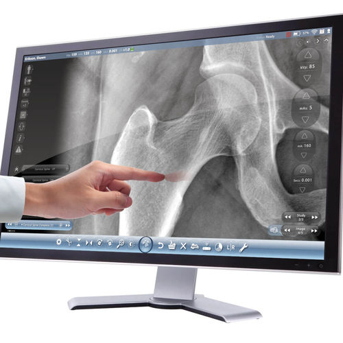 Radiology software Cuattro Europe image analysis / infection