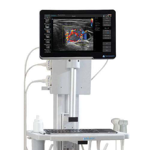 Portable, with trolley ultrasound system - uSmart® 3200T Plus - Terason - for multipurpose ultrasound imaging / B/W / color doppler
