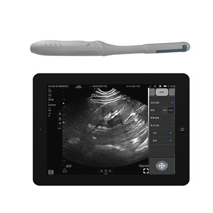 Hand-held ultrasound system - CProbe-4TR  - Sonostar Technologies - for endovaginal ultrasound imaging / B/W / color doppler